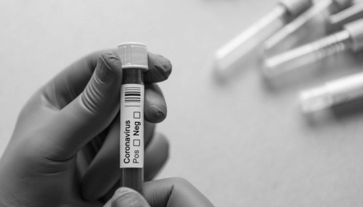 Händer som håller ett coronatest