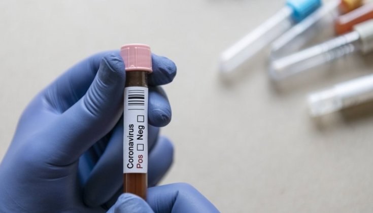 Händer med handskar som håller ett covid-provrör